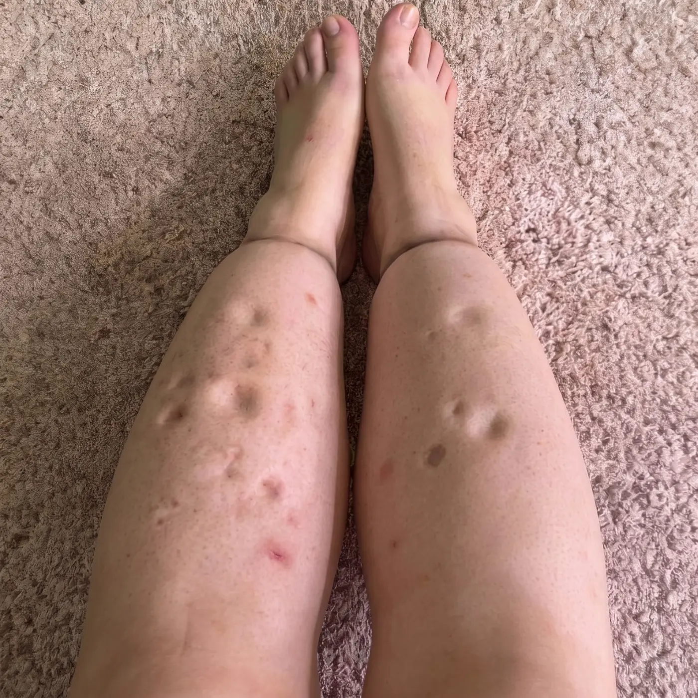 Photograph of lower legs showing the cutoff pattern above the ankle